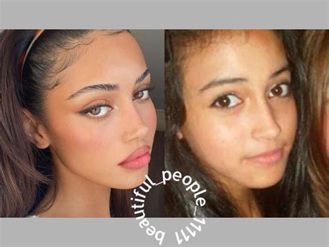 cindy nose|Cindy Kimberly Before and After Plastic Surgery: Lips, Nose, Face